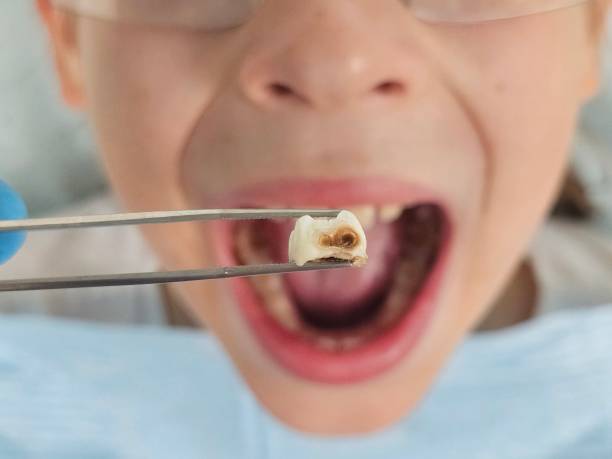 Best Broken Tooth Emergency  in Auburn, AL