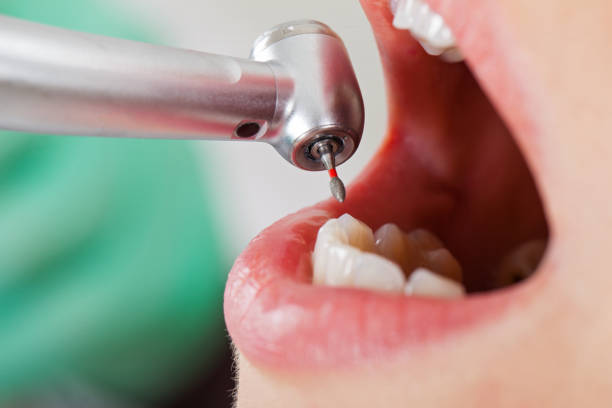 Urgent Tooth Repair in AL